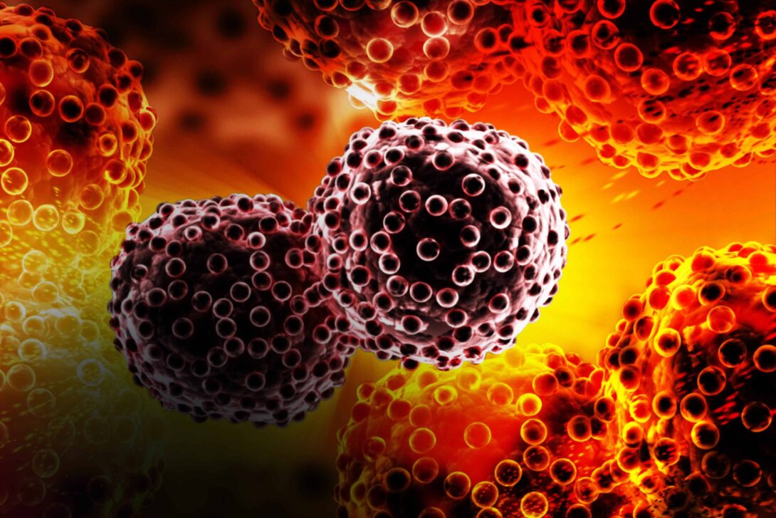 Lung Cancer Gradient