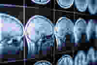 Image: Jalisko / Shutterstock