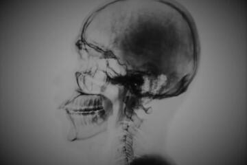Remain brain